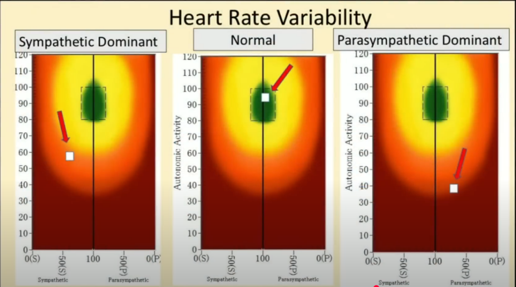 Autonomic sympathetic or parasympathetic dominant